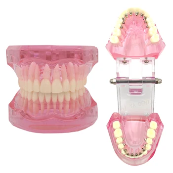 Стоматологичен модел на зъбите, Невидими Ортодонтски модели За изучаване на преподаване Обучение на пациенти на Стоматологични материали M3004