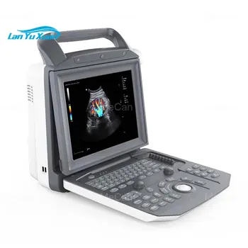 Ултразвуков Скенер 3D 4D Преносим Медицински Стандарт Цветен Допплеровский Апарат за сканиране на бременност Prob 4d 4d